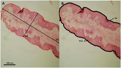 Feedlot performance, rumen and cecum morphometrics of Nellore cattle fed increasing levels of diet starch containing a blend of essential oils and amylase or monensin
